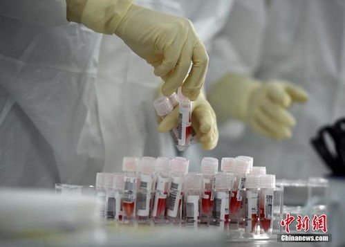 探訪新冠肺炎病毒核酸檢測(cè)服務(wù)